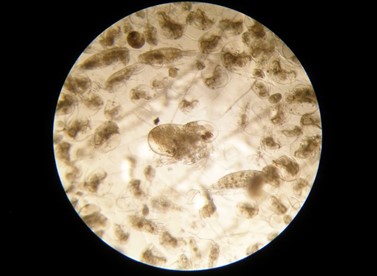 Próbka zooplanktonu widoczna pod mikroskopem stereoskopowym (fot. E. Wiktorowicz).